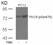 Polyclonal Antibody to PKC Theta (Phospho-Ser676)