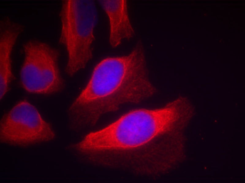 Polyclonal Antibody to IKK-beta(Phospho-Tyr199)