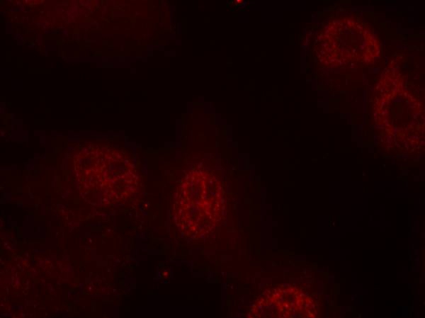 Polyclonal Antibody to Myc (Phospho-Ser62)