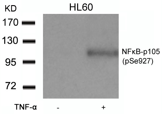 Polyclonal Antibody to NFkB-p105/p50 (Phospho-Ser927)