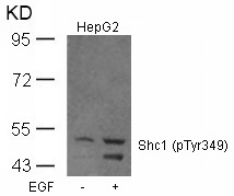 Polyclonal Antibody to Shc1 (Phospho-Tyr349)