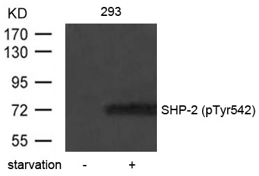 Polyclonal Antibody to SHP-2 (Phospho-Tyr542)