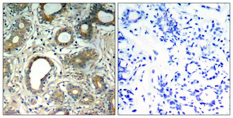 Polyclonal Antibody to SHP-2 (Phospho-Tyr580)