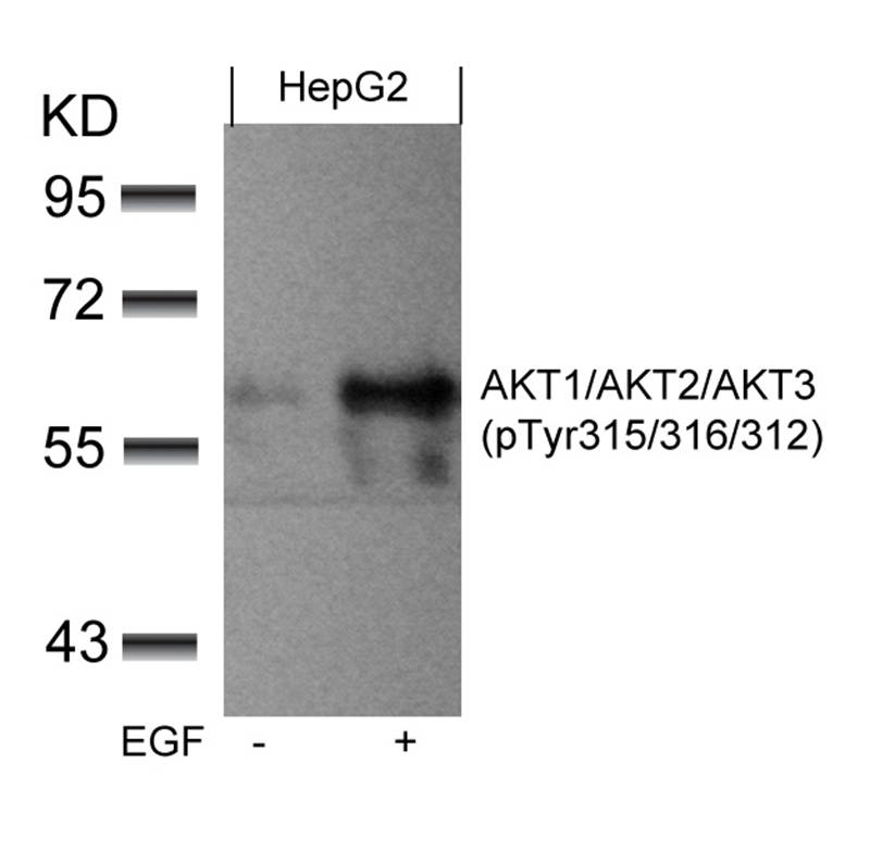 Polyclonal Antibody to AKT1/AKT2/AKT3 (phospho-Tyr315/316/312)