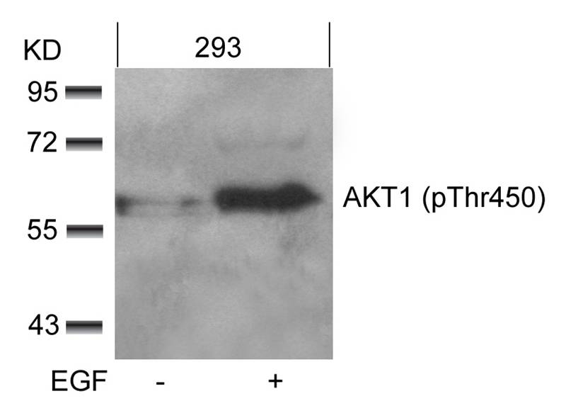 Polyclonal Antibody to AKT1 (phospho-Thr450)