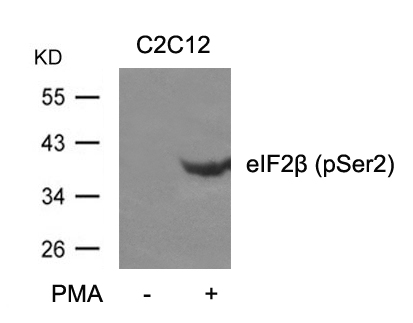 Polyclonal Antibody to eIF2beta (phospho-Ser2)