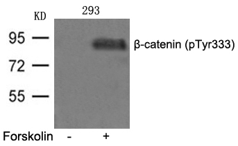Polyclonal Antibody to beta-catenin (phospho-Tyr333)