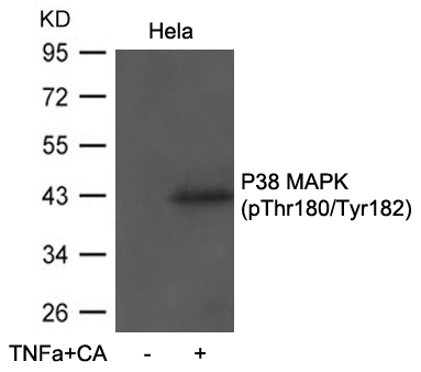 Polyclonal Antibody to P38 MAPK(Phospho-Thr180/Tyr182)