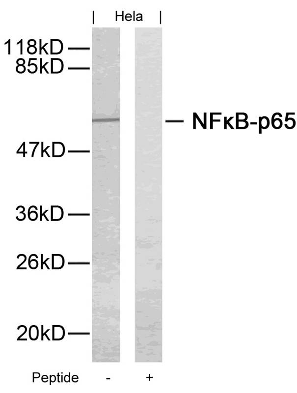 Polyclonal Antibody to NFkB-p65 (Ab-276)