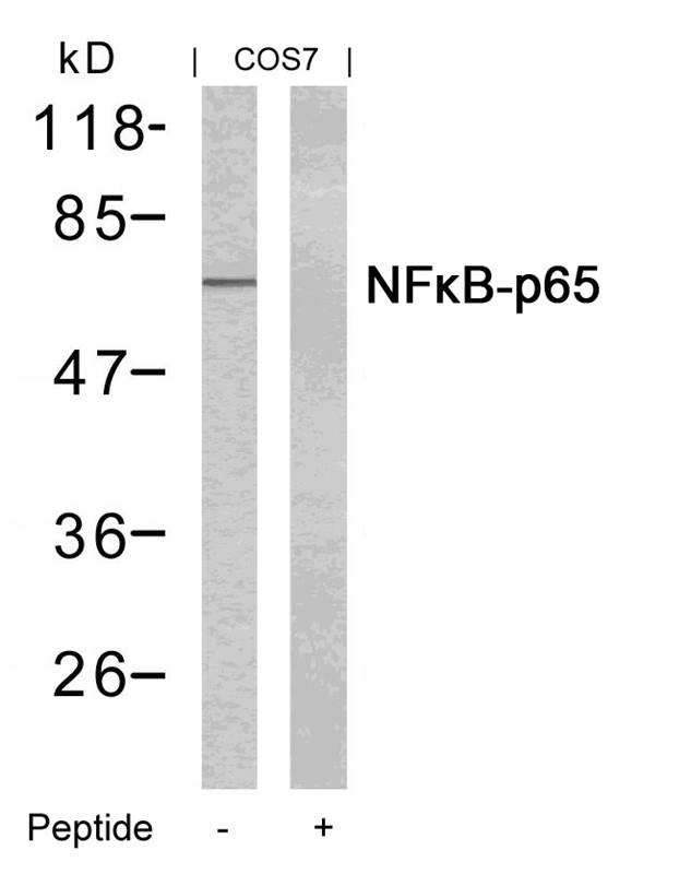 Polyclonal Antibody to NFkB -p65 (Ab-435)