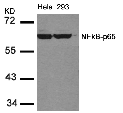 Polyclonal Antibody to NFkB-p65 (Ab-536)