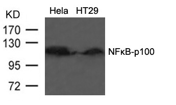 Polyclonal Antibody to NFkB-p100/p52 (Ab-866)