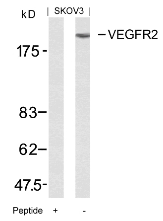 Polyclonal Antibody to VEGFR2 (Ab-951)
