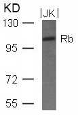 Polyclonal Antibody to Rb (Ab-780)