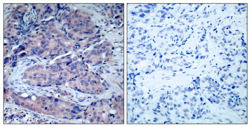 Polyclonal Antibody to SEK1/MKK4 (Ab-261)