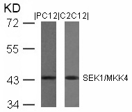 Polyclonal Antibody to SEK1/MKK4 (Ab-80)