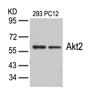 Polyclonal Antibody to Akt2 (Ab-474)