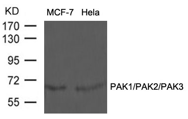 Polyclonal Antibody to PAK1/PAK2/PAK3 (Ab-423/402/421)