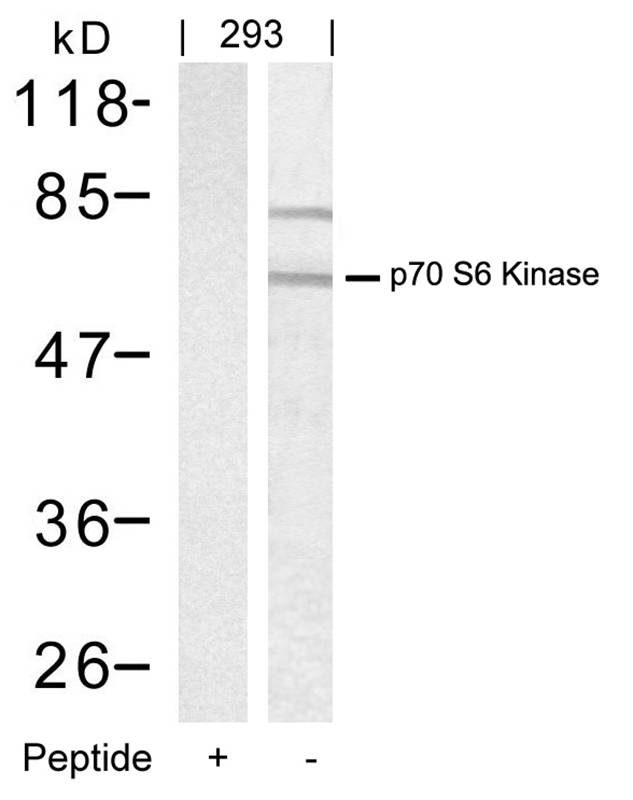 Polyclonal Antibody to p70 S6 Kinase (Ab-389)