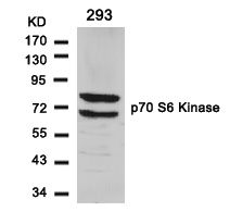 Polyclonal Antibody to p70 S6 Kinase (Ab-411)
