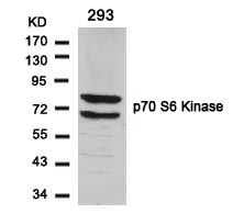 Polyclonal Antibody to p70 S6 Kinase (Ab-424)