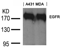 Goat Polyclonal Antibody to EGFR (Ab-1197)