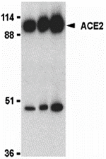 ACE2 Antibody ACE2 Antibody