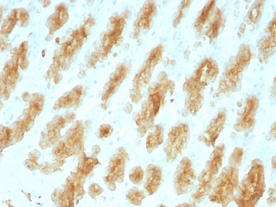 Monoclonal Antibody to Cytokeratin, Acidic (Type I or LMW) (Epithelial Marker)(Clone : KRTL/1077)