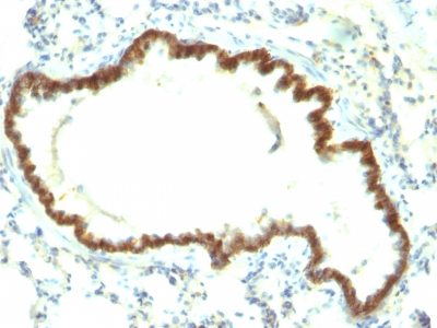 Monoclonal Antibody to Ep-CAM / CD326 (Rat) (Epithelial Marker)(Clone : Epcam/1159)