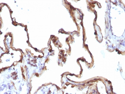 Monoclonal Antibody to Cytokeratin 7 (KRT7) (Glandular and Transitional Epithelial Marker)(Clone : KRT7/1198)