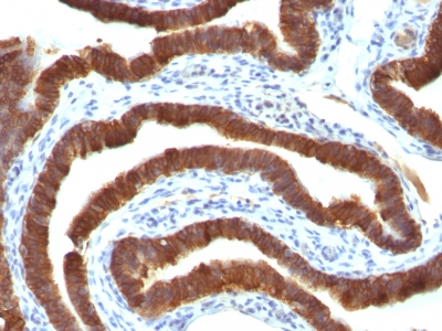 Monoclonal Antibody to Cytokeratin 19 (KRT19) (Pancreatic Stem Cell Marker)(Clone : Ks19.1)