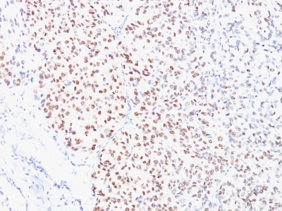 Monoclonal Antibody to Microphthalmia Transcription Factor (MITF)(Clone : D5)