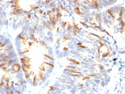 Monoclonal Antibody to MUC2 (Mucin 2)(Clone : SPM513)