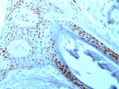 Formalin-fixed paraffin-embedded human Skin stained with Nucleolin Monoclonal Antibody (364-5).