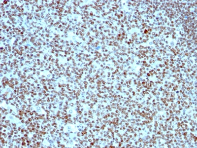 Formalin-fixed paraffin-embedded human Tonsil stained with Nucleolin Monoclonal Antibody (364-5).