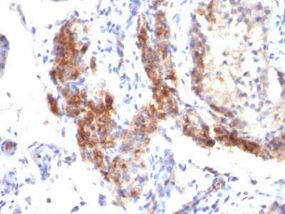 Monoclonal Antibody to FOXP3 (Forkhead Box Protein P3) / Scurfin(Clone : SPM579)