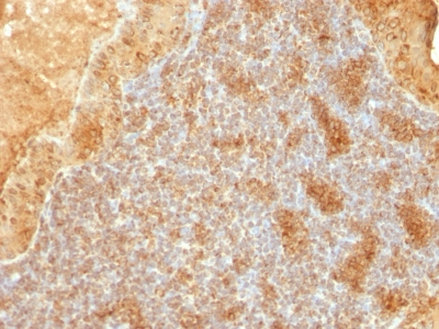 Monoclonal Antibody to Cytochrome C (Mitochondrial Marker)(Clone : SPM389)
