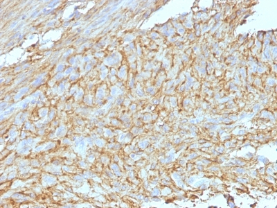 Monoclonal Antibody to DOG-1 / TMEM16A / ANO1 (Gastrointestinal Stromal Tumor Marker)(DG1/447 + DOG-1.1)