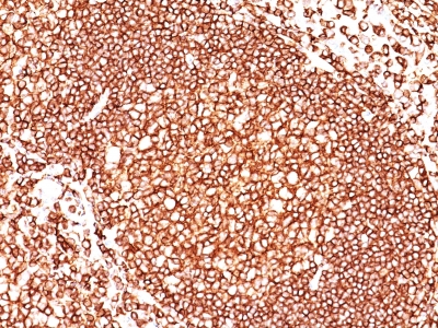 Monoclonal Antibody to CD45 / LCA (Leucocyte Marker)(Clone : 136-4B5)