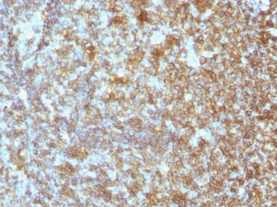 Monoclonal Antibody to CD45 / LCA (Leucocyte Marker)(Clone : SPM496)