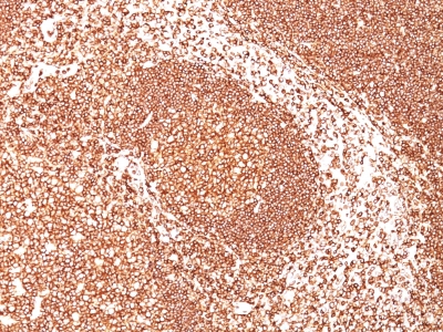 Monoclonal Antibody to CD45 / LCA (Leucocyte Marker)(Clone : 2B11)