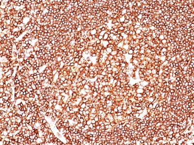Monoclonal Antibody to CD45 / LCA (Leucocyte Marker)(Clone : 2B11)