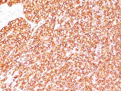 Monoclonal Antibody to CD45 / LCA (Leucocyte Marker)(Clone : SPM570)