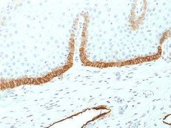 Anti-Podoplanin (PDPN) (Lymphatic Endothelial & Mesothelial Marker) Monoclonal Antibody (Clone: PDPN/1433)