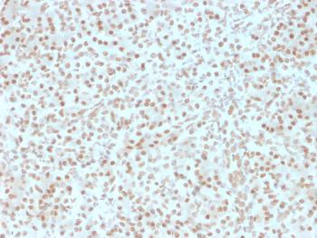 Anti-AKT1 (Prognostic Marker for Neuroendocrine Tumors) Monoclonal Antibody(Clone: AKT1/2491)