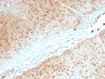 Anti-AKT1 (Prognostic Marker for Neuroendocrine Tumors) Monoclonal Antibody(Clone: AKT1/2552)
