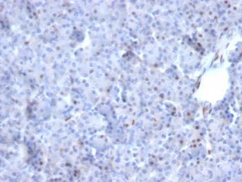 Anti-AKT1 (Prognostic Marker for Neuroendocrine Tumors) Monoclonal Antibody(Clone: AKT1/2784)