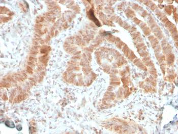 Anti-AKT1 (Prognostic Marker for Neuroendocrine Tumors) Monoclonal Antibody(Clone: rAKT1/2491)