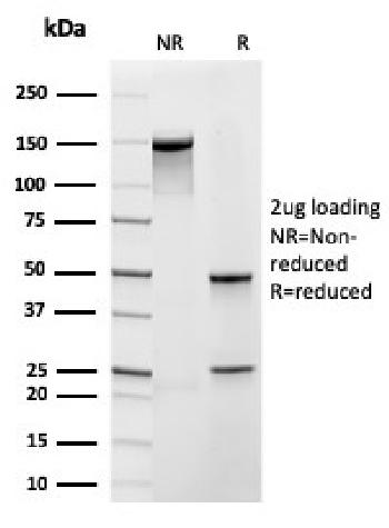 Fig. 1: SDS-PAGE Analysis Purified Frataxin Recombinant Mouse Monoclonal Antibody (rFXN/2124). Confirmation of Purity and Integrity of Antibody.