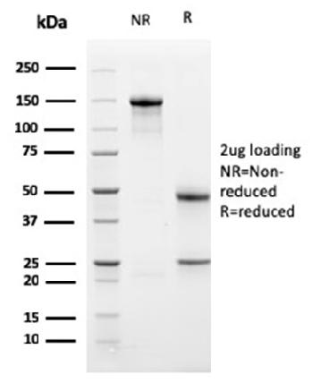 Anti-PD-L1 / PDCD1LG1 / CD274 / B7-H1 (Cancer Immunotherapy Target) Monoclonal Antibody(Clone: PDL1/2741)